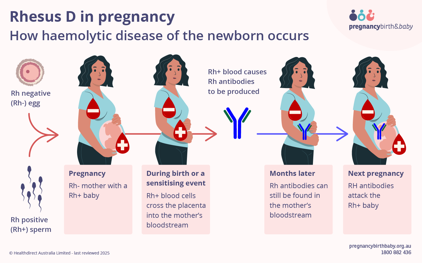 Diagram showing how haemolytic disease of the newborn can occur.